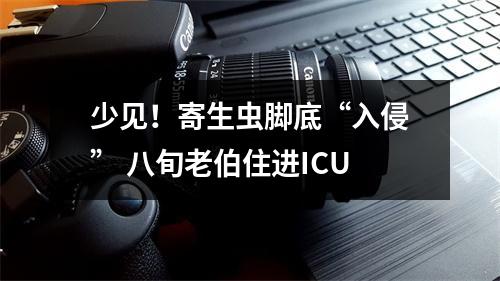 少见！寄生虫脚底“入侵” 八旬老伯住进ICU