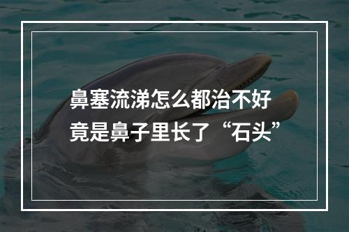 鼻塞流涕怎么都治不好 竟是鼻子里长了“石头”