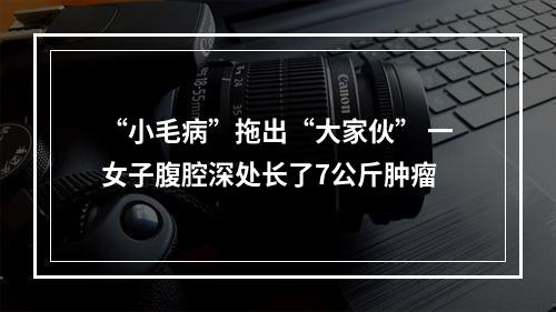“小毛病”拖出“大家伙” 一女子腹腔深处长了7公斤肿瘤