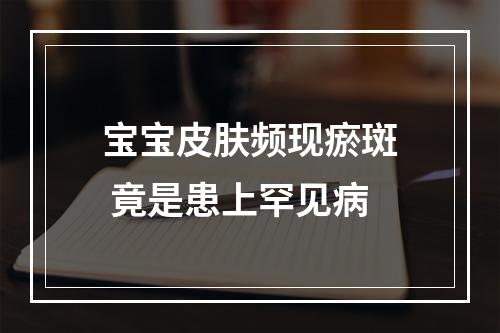 宝宝皮肤频现瘀斑 竟是患上罕见病