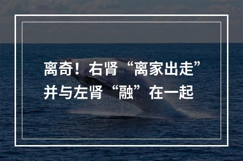 离奇！右肾“离家出走”并与左肾“融”在一起