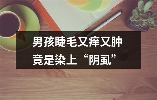 男孩睫毛又痒又肿 竟是染上“阴虱”