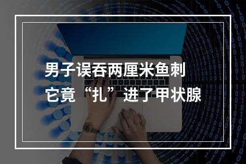 男子误吞两厘米鱼刺 它竟“扎”进了甲状腺