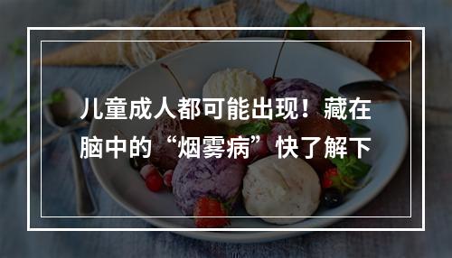 儿童成人都可能出现！藏在脑中的“烟雾病”快了解下