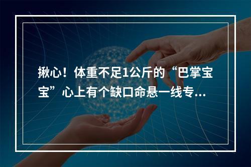 揪心！体重不足1公斤的“巴掌宝宝”心上有个缺口命悬一线专家在嫩如豆腐的心脏上成功补洞
