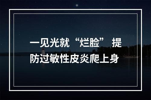 一见光就“烂脸” 提防过敏性皮炎爬上身