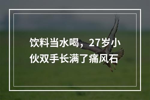 饮料当水喝，27岁小伙双手长满了痛风石