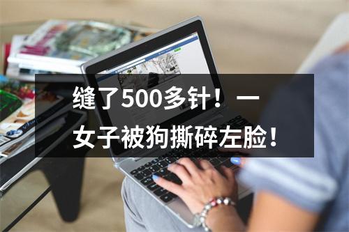 缝了500多针！一女子被狗撕碎左脸！