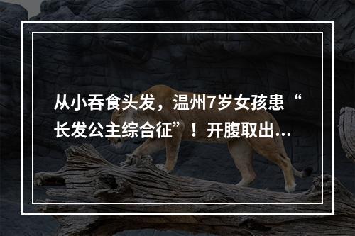 从小吞食头发，温州7岁女孩患“长发公主综合征”！开腹取出巨大“毛球”……