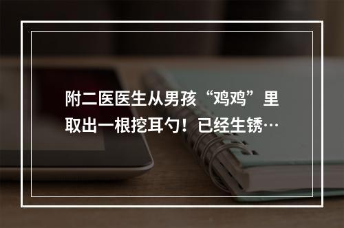 附二医医生从男孩“鸡鸡”里取出一根挖耳勺！已经生锈…