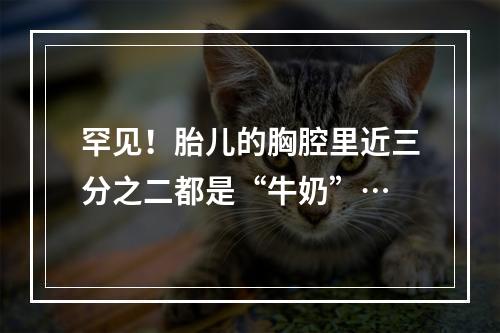 罕见！胎儿的胸腔里近三分之二都是“牛奶”…