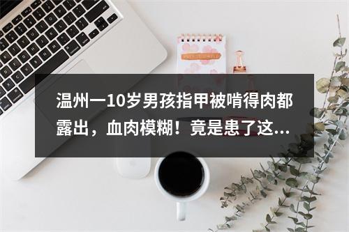 温州一10岁男孩指甲被啃得肉都露出，血肉模糊！竟是患了这种病…