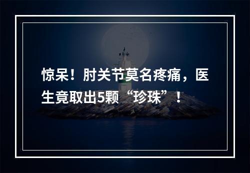 惊呆！肘关节莫名疼痛，医生竟取出5颗“珍珠”！