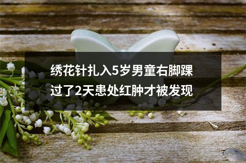 绣花针扎入5岁男童右脚踝 过了2天患处红肿才被发现