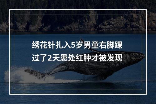 绣花针扎入5岁男童右脚踝 过了2天患处红肿才被发现