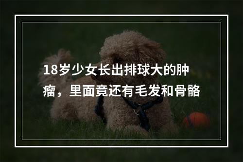 18岁少女长出排球大的肿瘤，里面竟还有毛发和骨骼