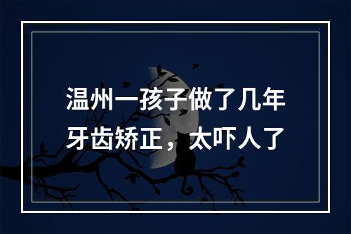 温州一孩子做了几年牙齿矫正，太吓人了