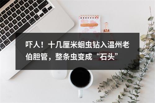 吓人！十几厘米蛔虫钻入温州老伯胆管，整条虫变成“石头”