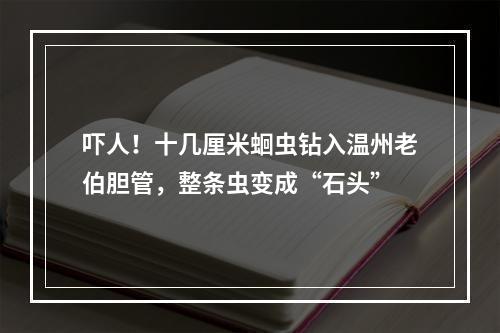 吓人！十几厘米蛔虫钻入温州老伯胆管，整条虫变成“石头”