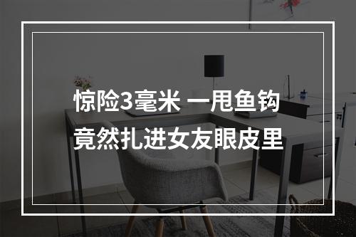 惊险3毫米 一甩鱼钩竟然扎进女友眼皮里