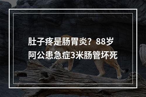 肚子疼是肠胃炎？88岁阿公患急症3米肠管坏死
