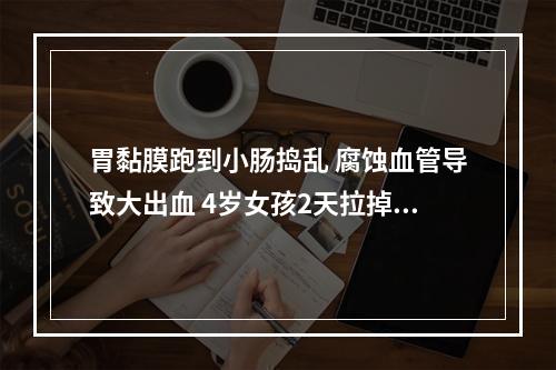 胃黏膜跑到小肠捣乱 腐蚀血管导致大出血 4岁女孩2天拉掉全身“一半血液”
