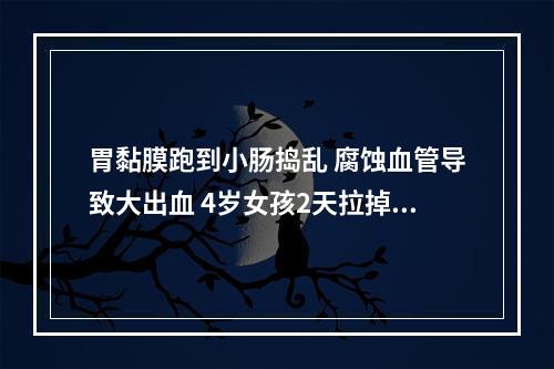 胃黏膜跑到小肠捣乱 腐蚀血管导致大出血 4岁女孩2天拉掉全身“一半血液”