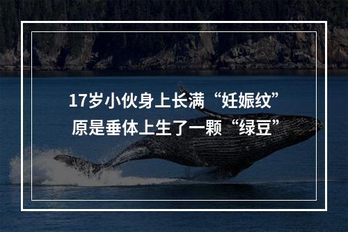 17岁小伙身上长满“妊娠纹” 原是垂体上生了一颗“绿豆”