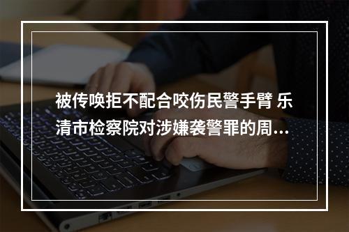 被传唤拒不配合咬伤民警手臂 乐清市检察院对涉嫌袭警罪的周某某提起公诉
