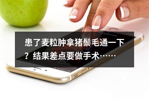 患了麦粒肿拿猪鬃毛通一下？结果差点要做手术……