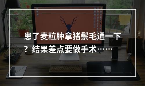 患了麦粒肿拿猪鬃毛通一下？结果差点要做手术……