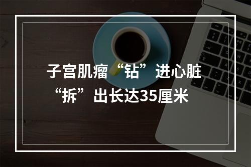 子宫肌瘤“钻”进心脏 “拆”出长达35厘米