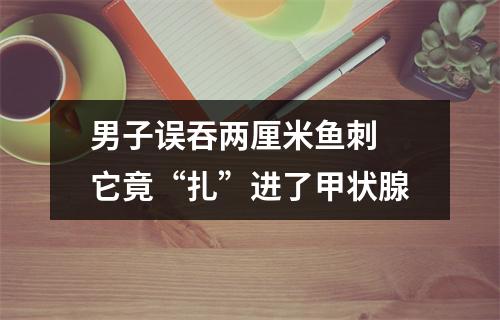 男子误吞两厘米鱼刺 它竟“扎”进了甲状腺